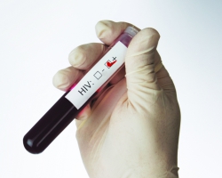 Откроются мобильные пункты тестирования на ВИЧ