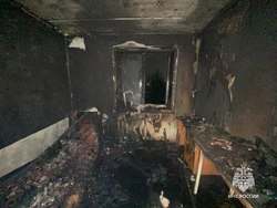 Курильщика госпитализировали с ожогами после пожара