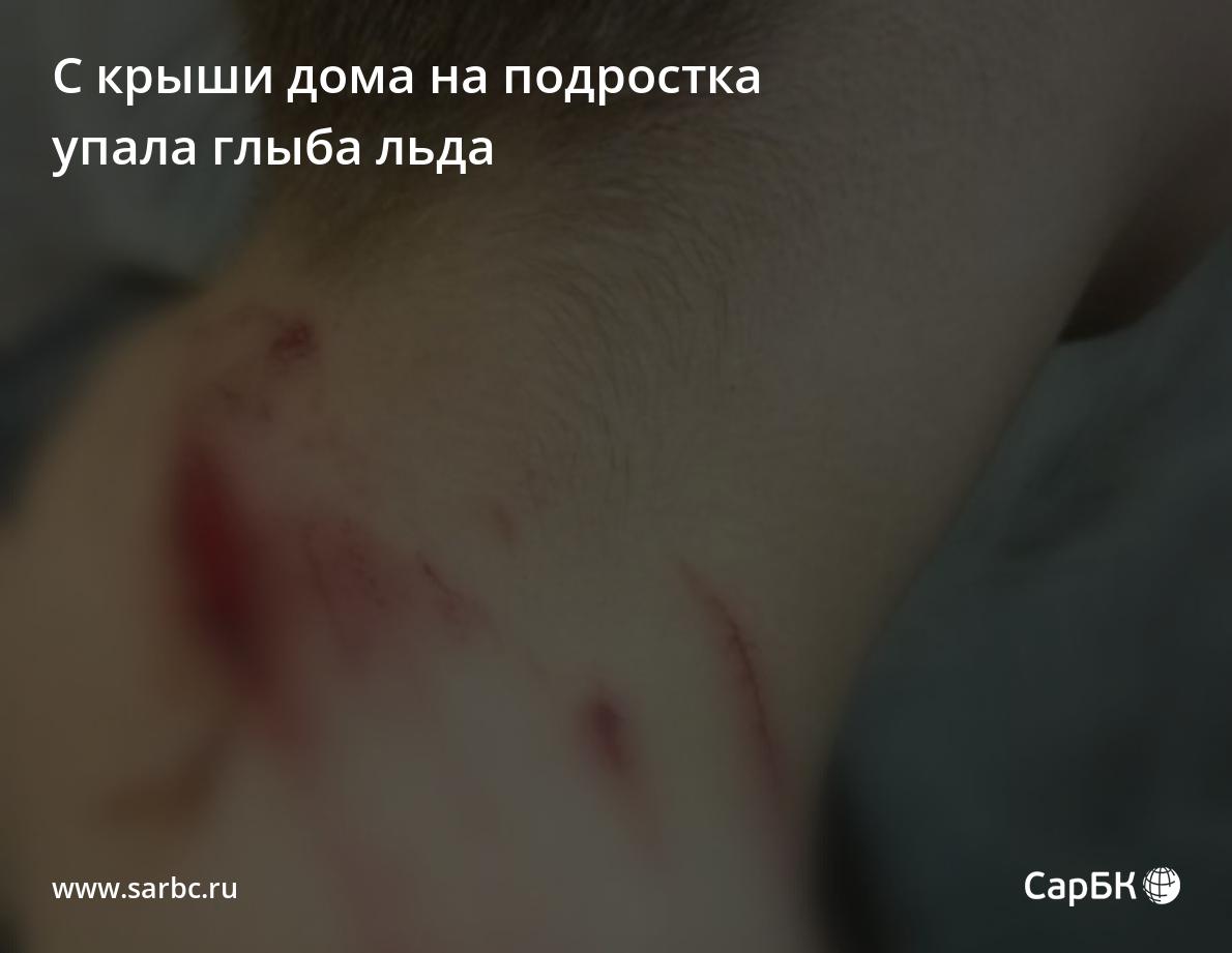 С крыши дома на Артиллерийской на подростка упала глыба льда