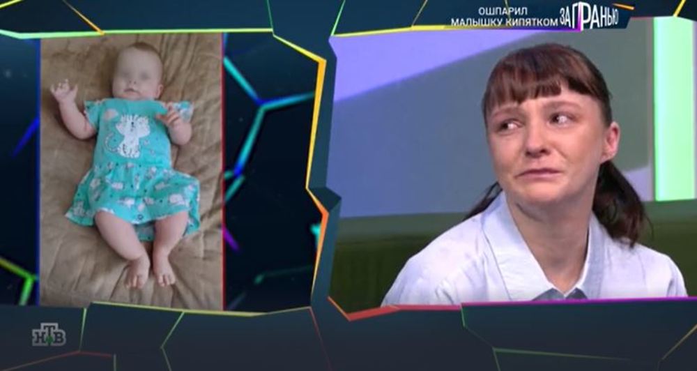 Смерть годовалой девочки от ожогов. Возбуждены еще три дела